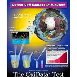 The Free Radical Test